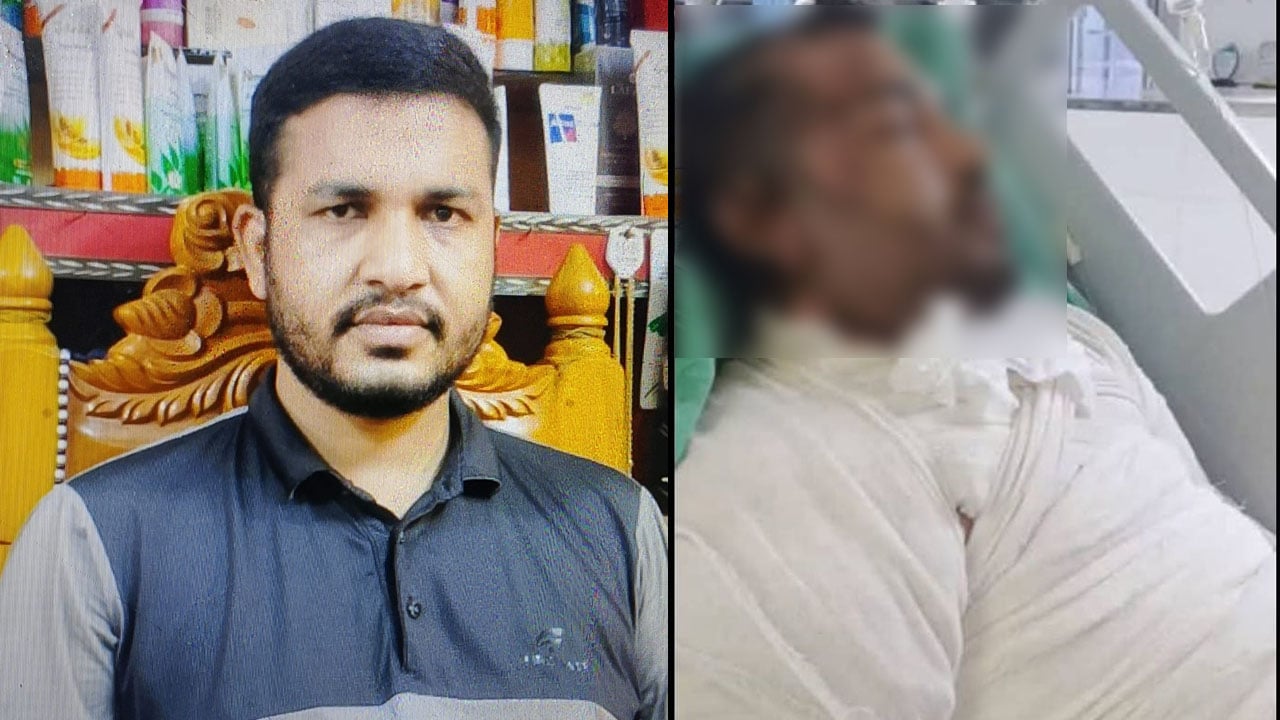 শ্রীপুরে ট্রান্সফরমার বিস্ফোরণে দগ্ধ জাকিরের মৃত্যু, মৃতের সংখ্যা বেড়ে ২