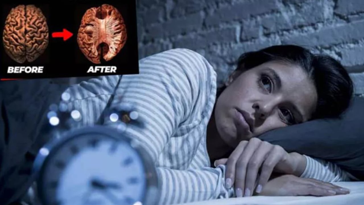 ঘুমের অভাবে ক্ষতিগ্রস্ত হচ্ছে মস্তিষ্কের কোষ