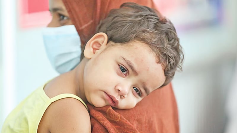 রাজশাহীতে হামের থাবা: ২৪ ঘণ্টায় আরও ৫ শিশুর মৃত্যু