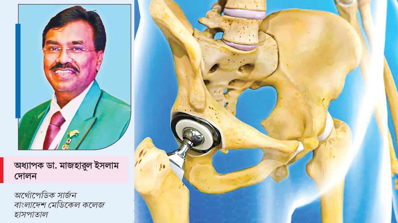 হিপ প্রতিস্থাপন সার্জারি ব্যথা কমায়
