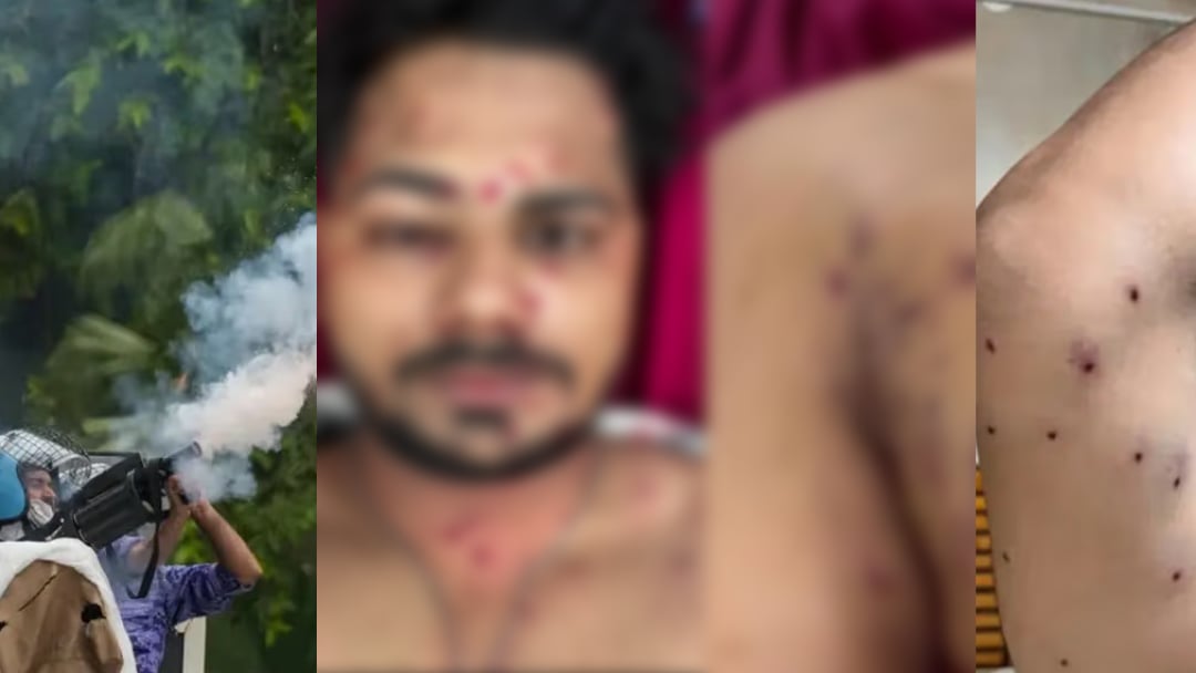 ভারতের বিক্ষোভে শিক্ষার্থীদের শরীরে ছররা গুলি, পুলিশের অস্বীকার