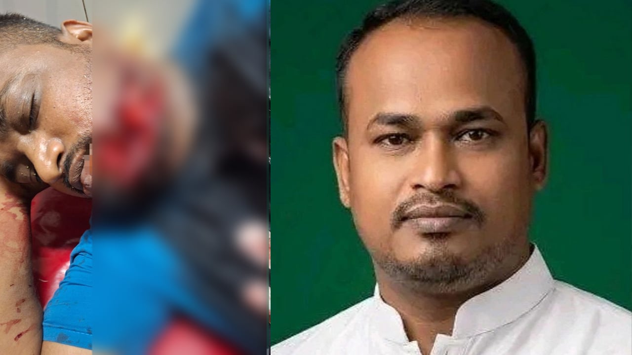 স্বেচ্ছাসেবক দলের আহ্বায়ককে কুপিয়ে হত্যার চেষ্টা