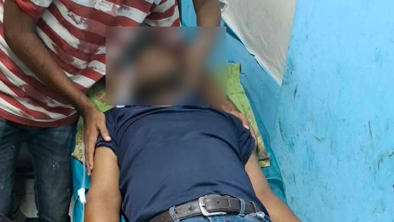 রূপসায় শ্রমিক দল নেতাকে হাতুড়িপেটা, দুই হাঁটুতে গুরুতর আঘাত
