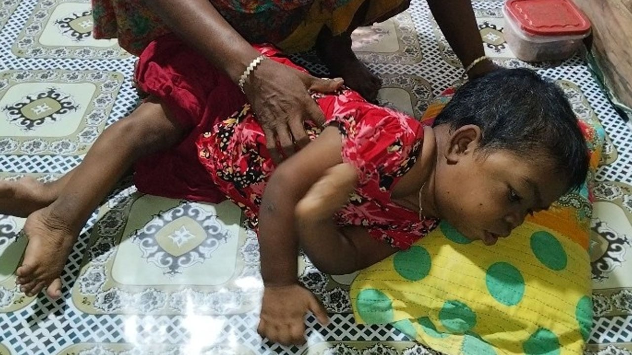 ২৪ বছরেও দাঁড়াতে পারেননি তুলি, সহায়তা চান বাবা-মা