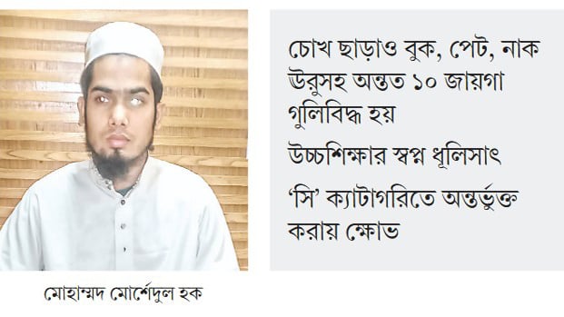 নিভে গেছে দুই চোখের আলো শরীরেও স্প্লিন্টারের যন্ত্রণা