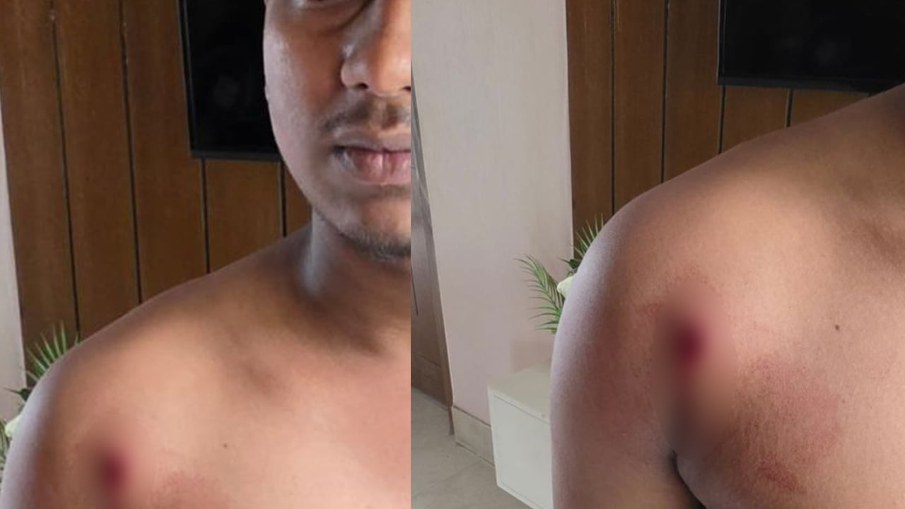 নারায়ণগঞ্জে যুবদলের দুপক্ষের সংঘর্ষ, গুলিবিদ্ধসহ আহত ২