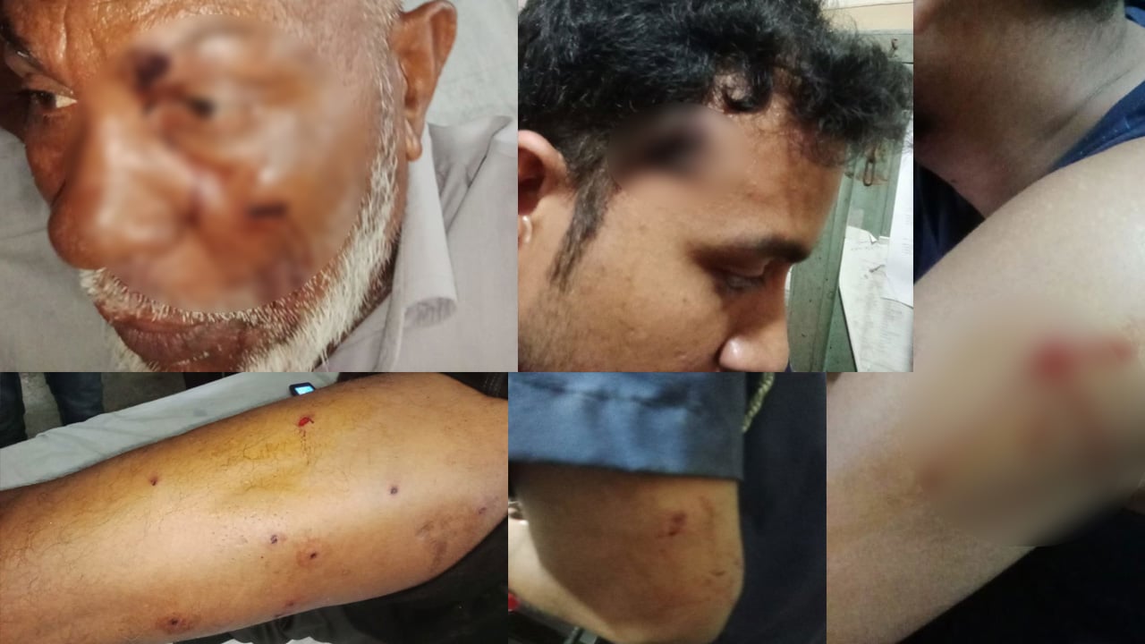 পদ্মায় টহলরত পুলিশের ওপর হামলা, ওসিসহ ৫ সদস্য গুলিবিদ্ধ