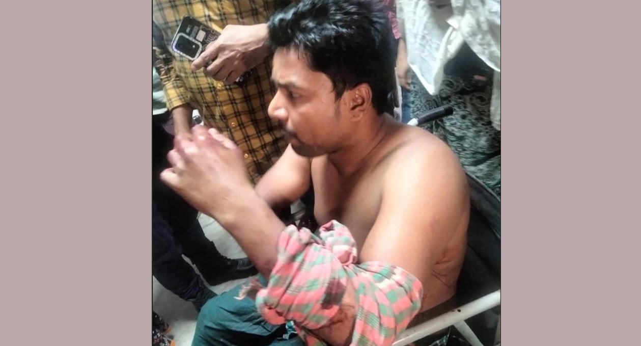 নলচরের সংঘর্ষে আহত তিনজন আইসিইউতে, অন্যরা শঙ্কামুক্ত