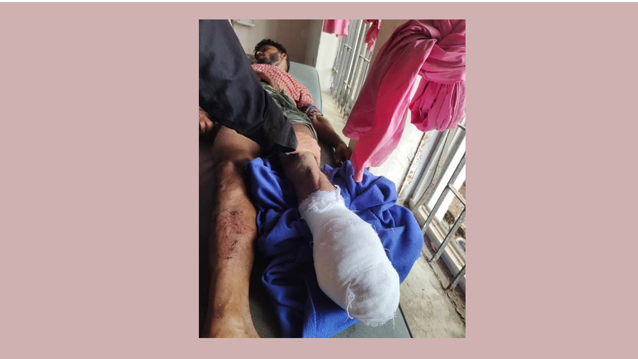 সীমান্তে মাইন বিস্ফোরণ, একজনের পায়ের গোড়ালি বিচ্ছিন্ন