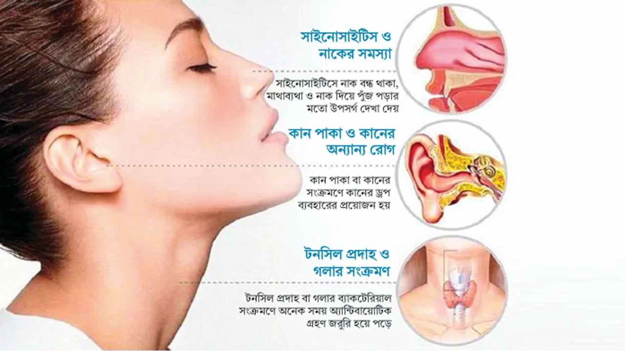 রোজায় নাক-কান গলার চিকিৎসা