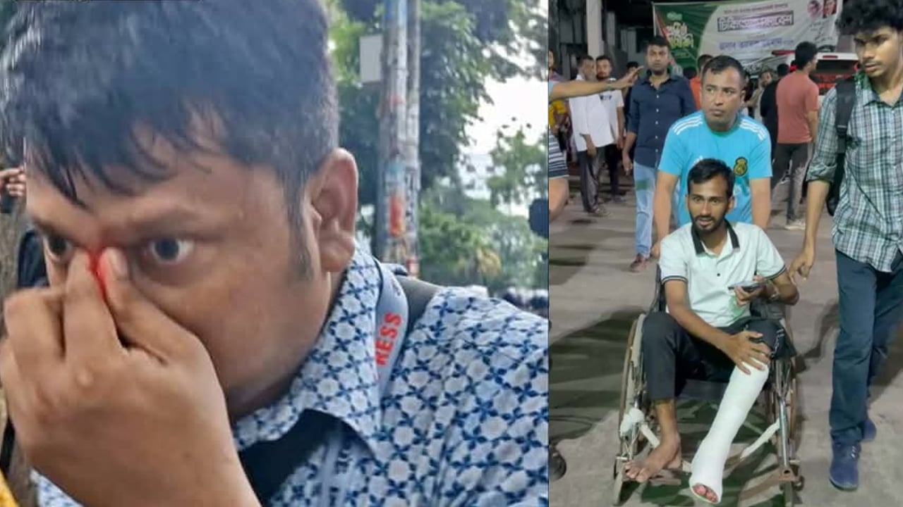 ছাত্রদল-শিবির সংঘর্ষে দুই সাংবাদিক আহত