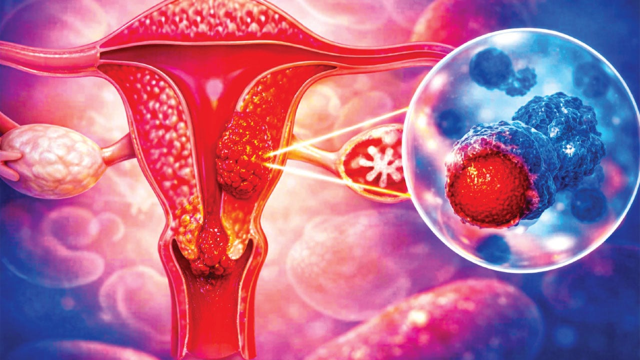 নিয়মিত স্ক্রিনিং কেন গুরুত্বপূর্ণ