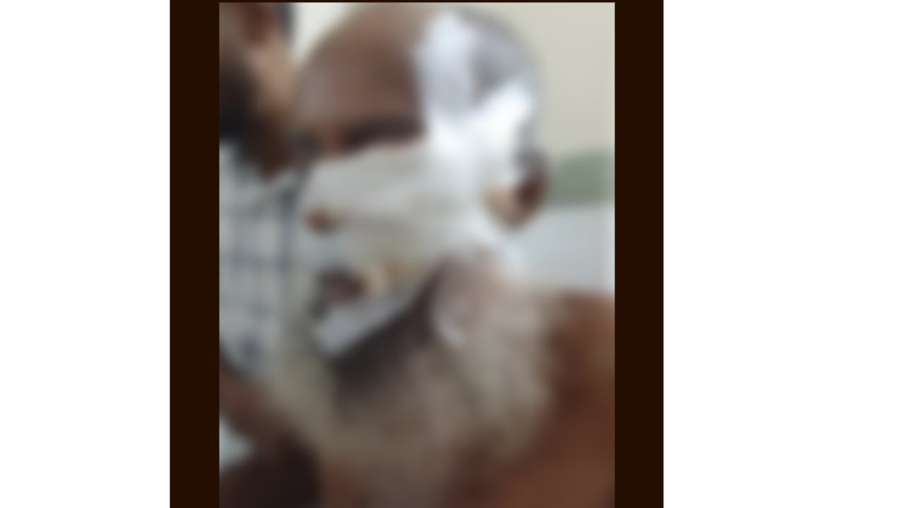 হাজীগঞ্জে শিয়ালের কামড়ে আহত ৮, সংকটাপন্ন বৃদ্ধ