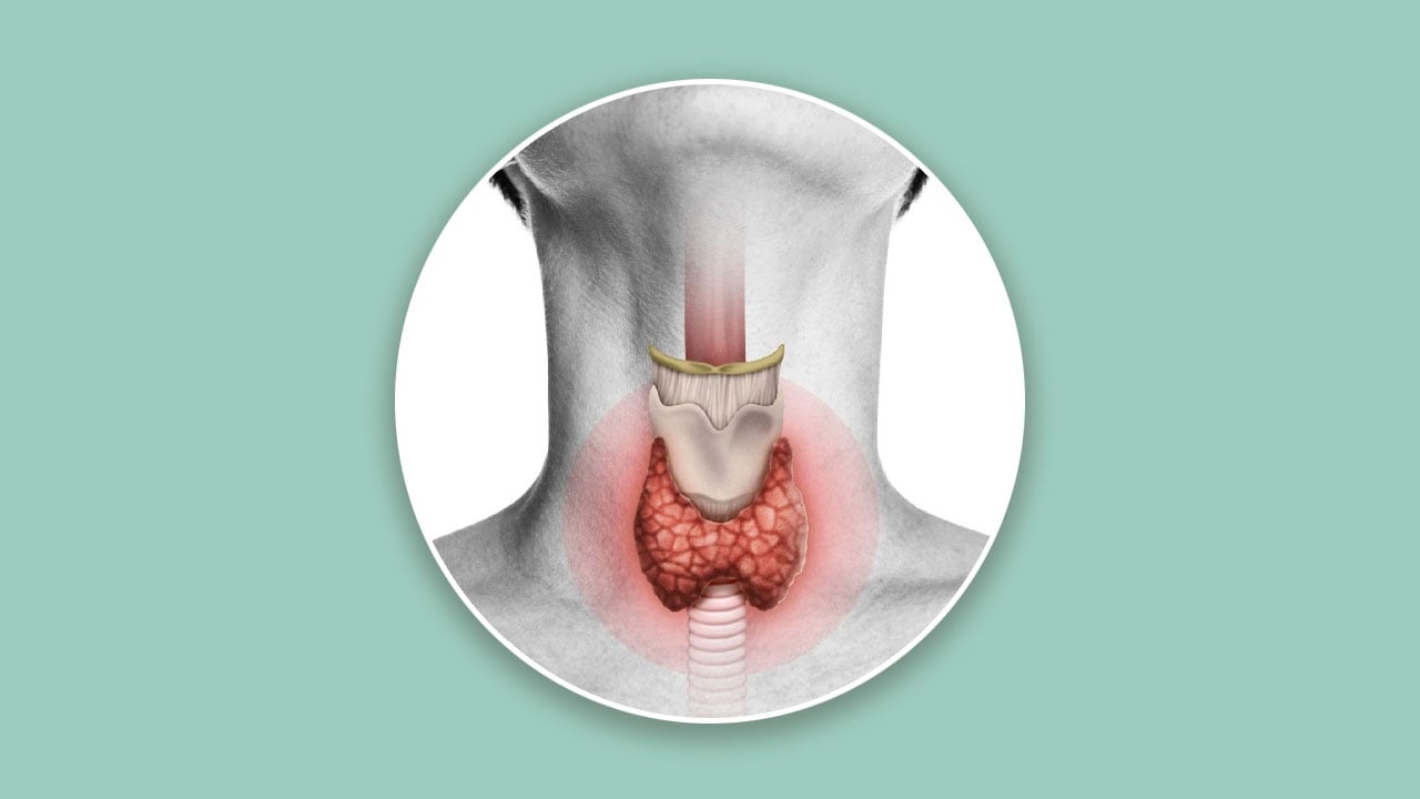 যেসব কারণে থাইরয়েড রোগে ভোগে শিশু