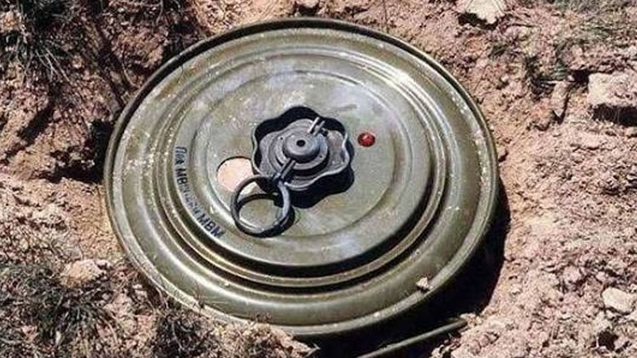 আরাকান আর্মির পুঁতে রাখা মাইন বিস্ফোরণে পা বিচ্ছিন্ন রোহিঙ্গা কিশোরের