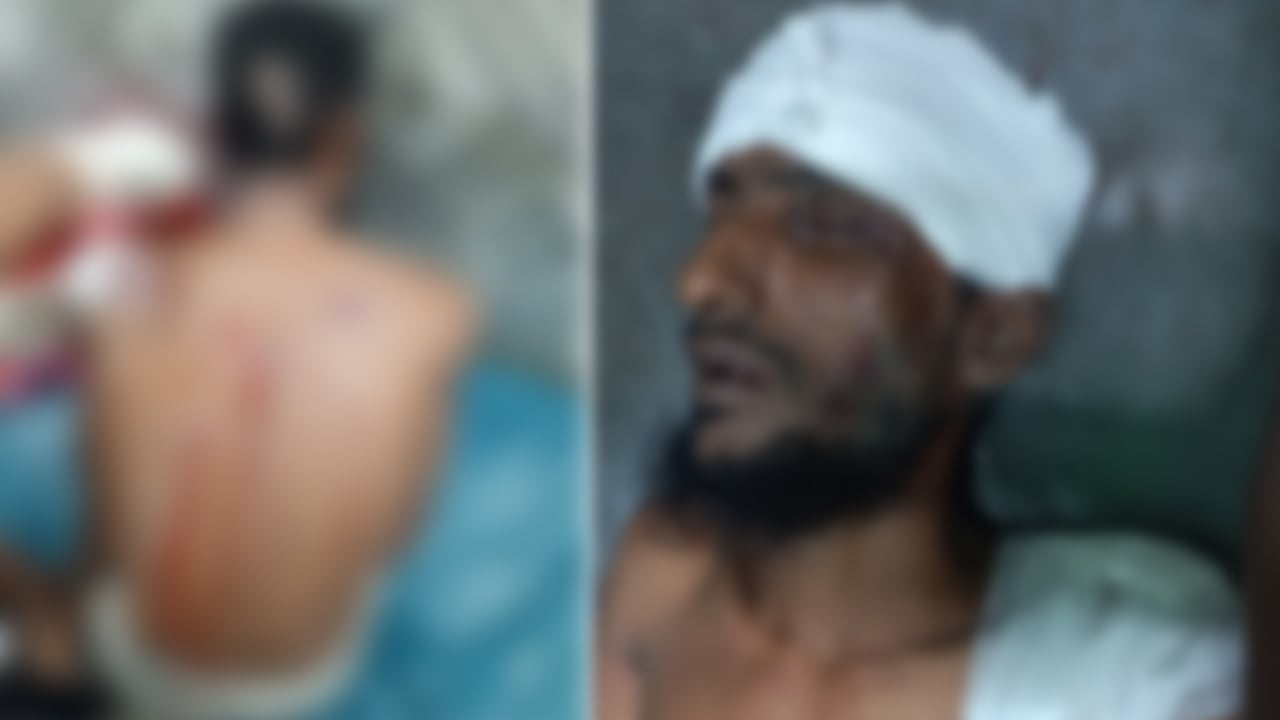 মোংলায় আওয়ামী সন্ত্রাসীদের হামলায় যুবদল কর্মী গুরুতর জখম