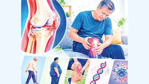 অস্থিসন্ধির ব্যথাকে অবহেলা নয়