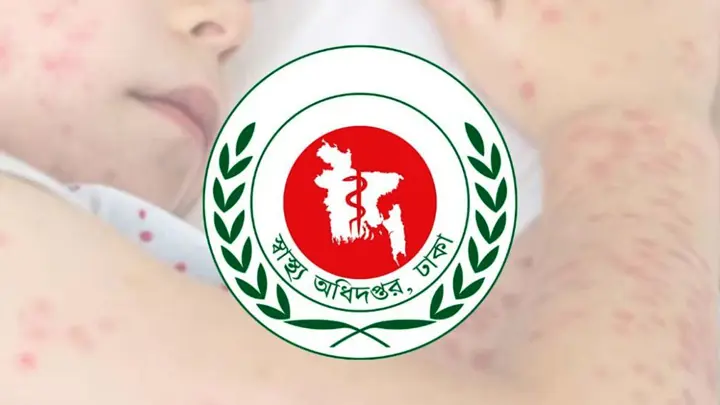 এক দিনে হাম উপসর্গে ৫ জনের মৃত্যু, আক্রান্ত ১৩৫৬