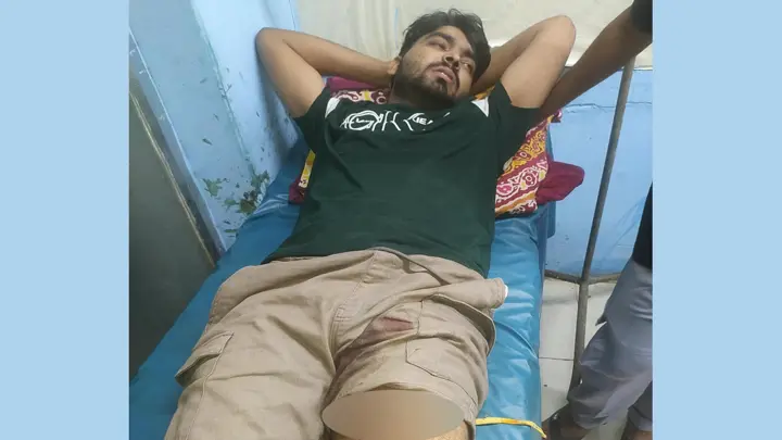 খুলনায় গুলি করে মোবাইল ছিনতাই, যুবক আহত