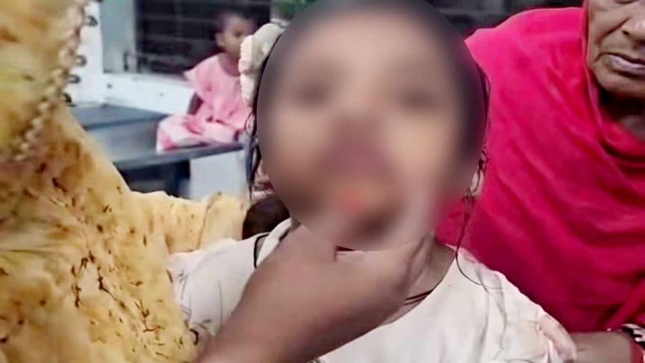 বিড়ালের আঁচড়ের পর ‘মিউ মিউ’ করছে শিশু, যা বললেন চিকিৎসক