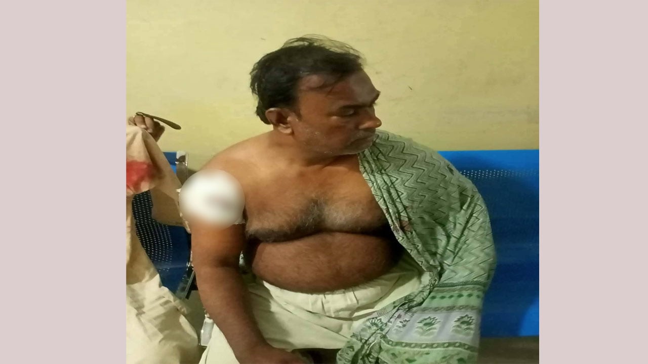 সন্দ্বীপে ব্যবসায়ী গুলিবিদ্ধ
